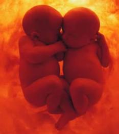 jumeaux in utero